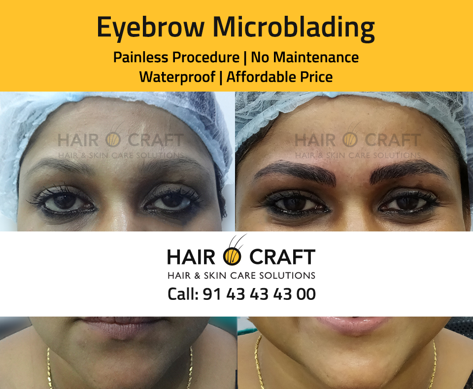 Microblading Before After Photo Gallery