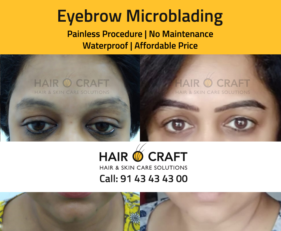 Eyebrow Microblading in Kerala | Hair O Craft