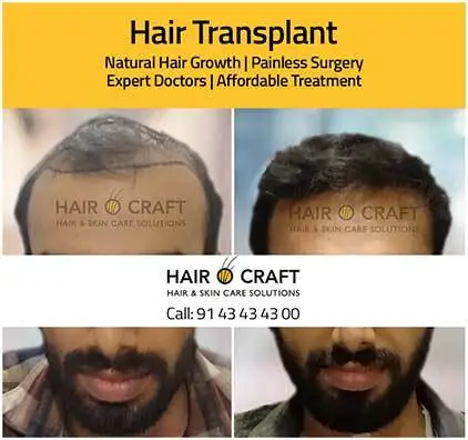 Hair clinic in Kochi