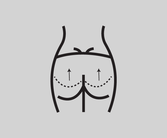 A. Brazilian Butt Lift (BBL) – Fat Transfer