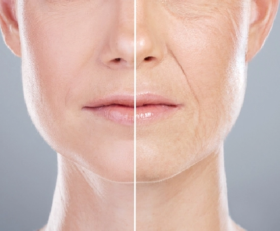 Smooth Out Wrinkles and Turn Back the Clock with Wrinkles Treatment at Hair O Craft