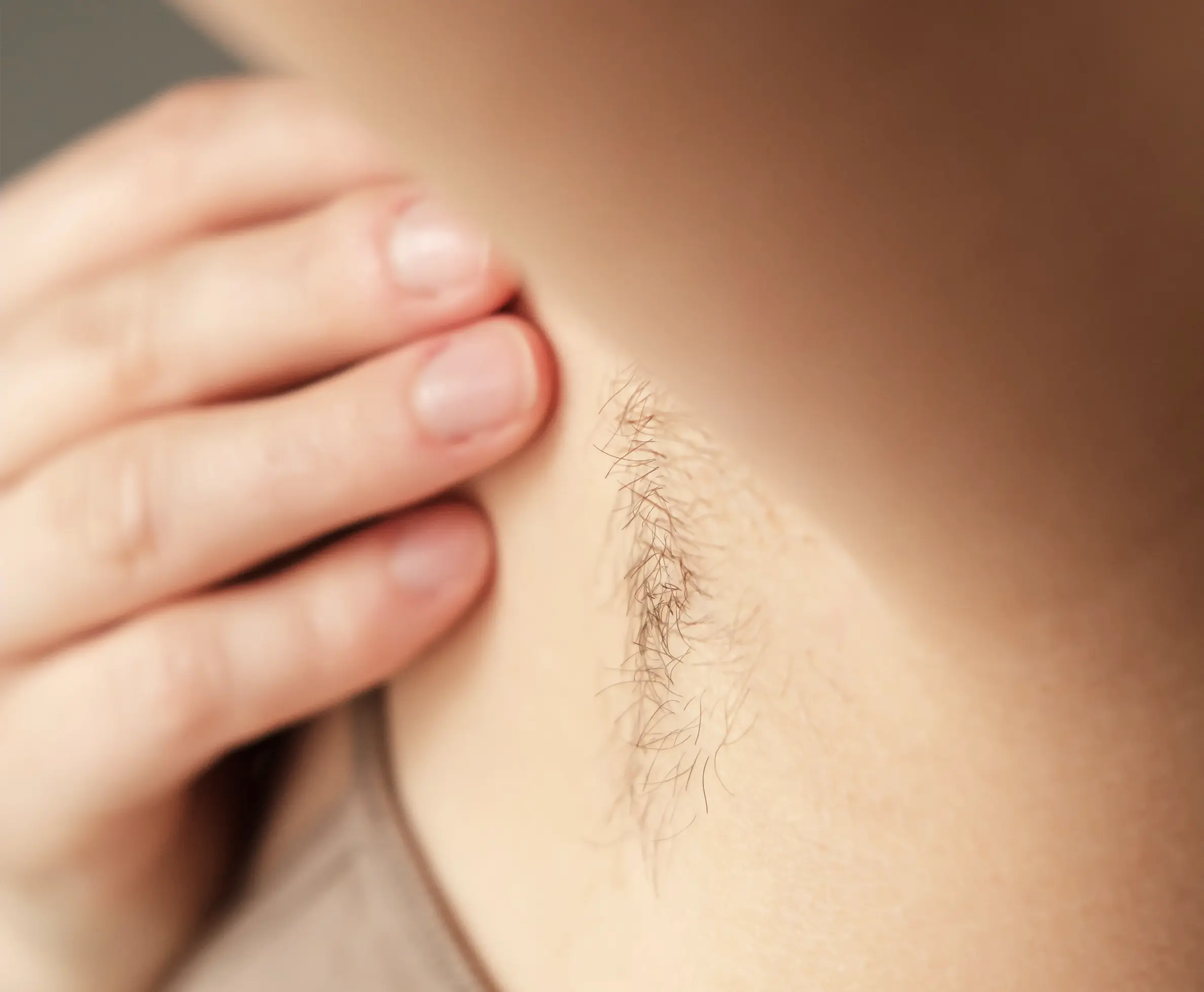 Why Choose Laser Hair Reduction?