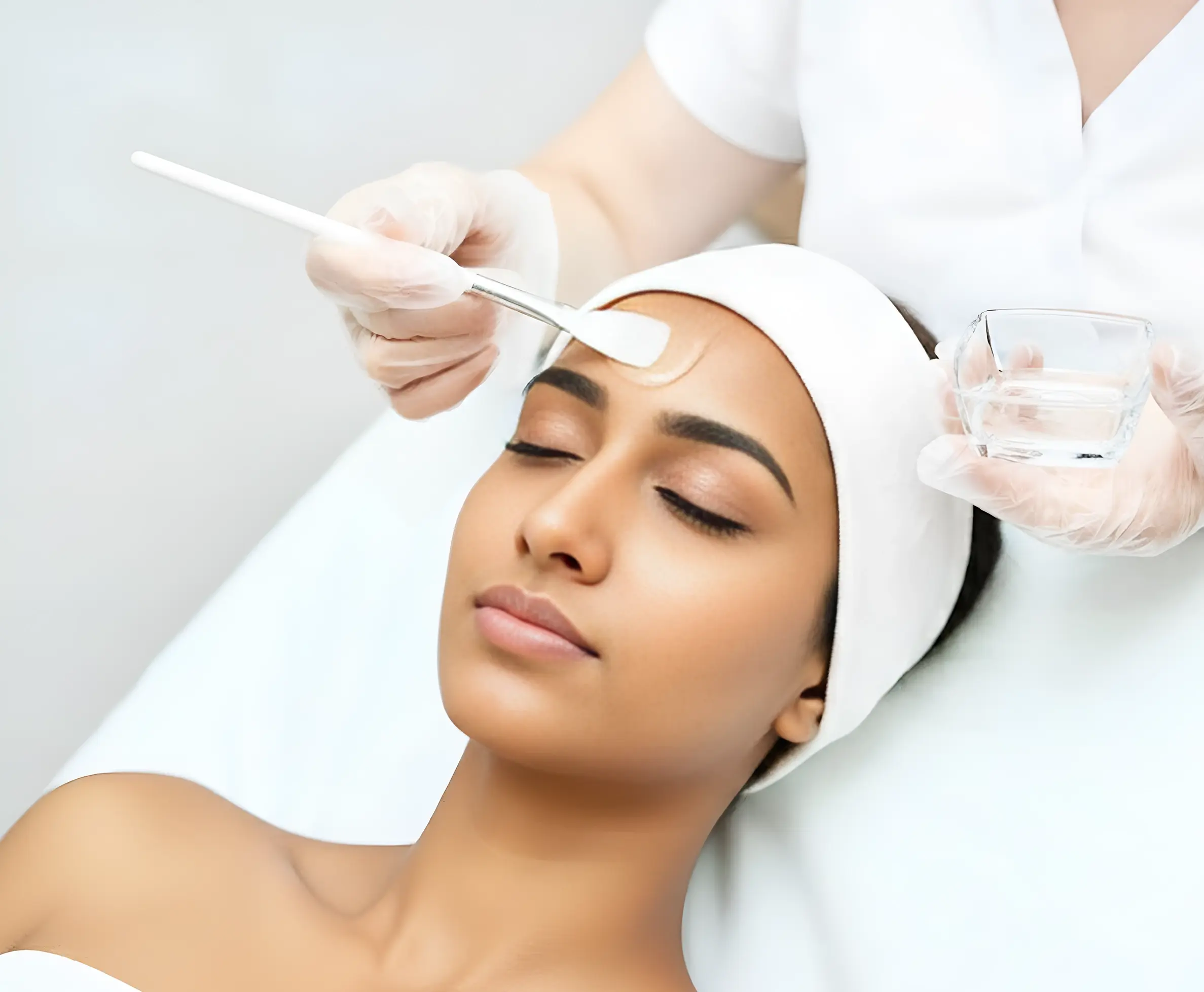 Chemical Peel Treatment in Kochi, Kozhikode, Bangalore, Thrissur, Kannur, Thiruvalla, Thiruvananthapuram & Chennai