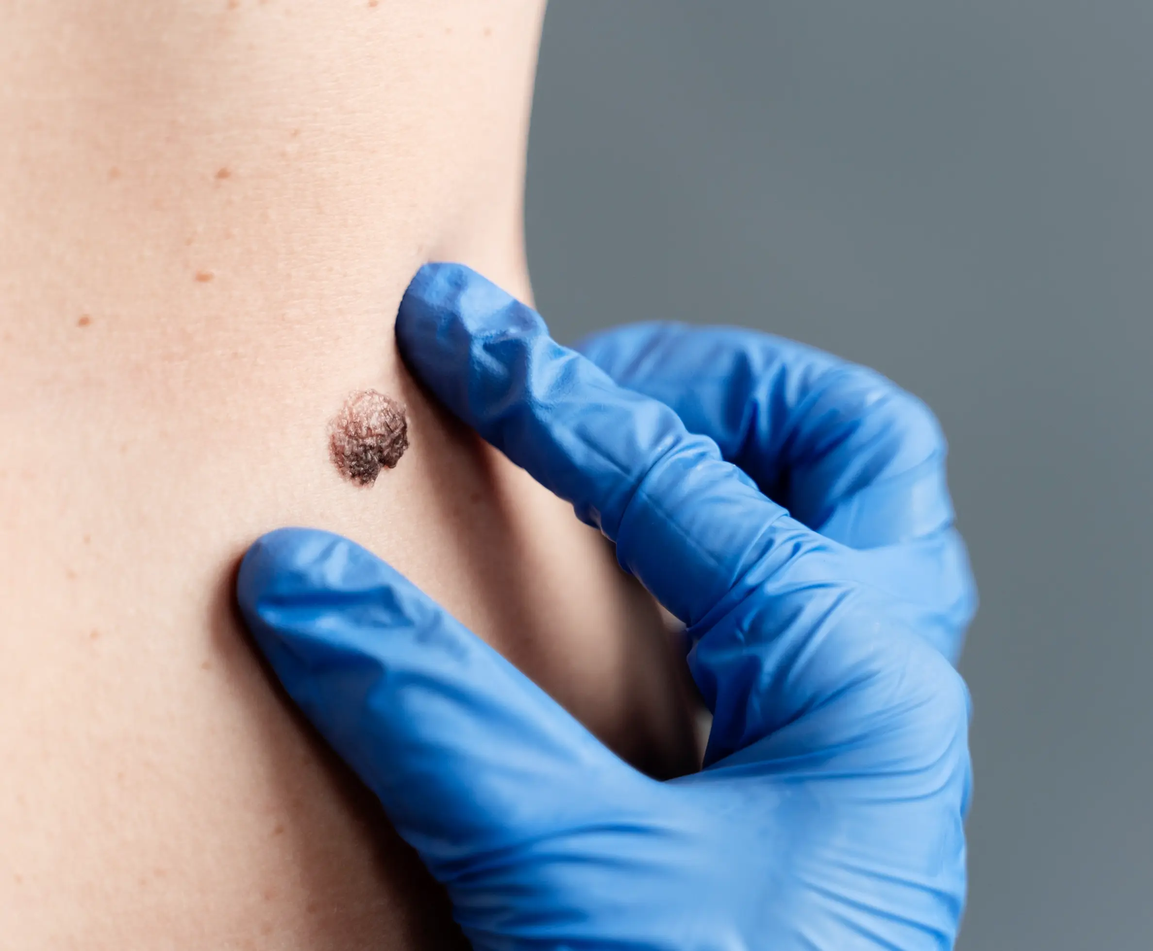 Who Can Consider This Treatment?