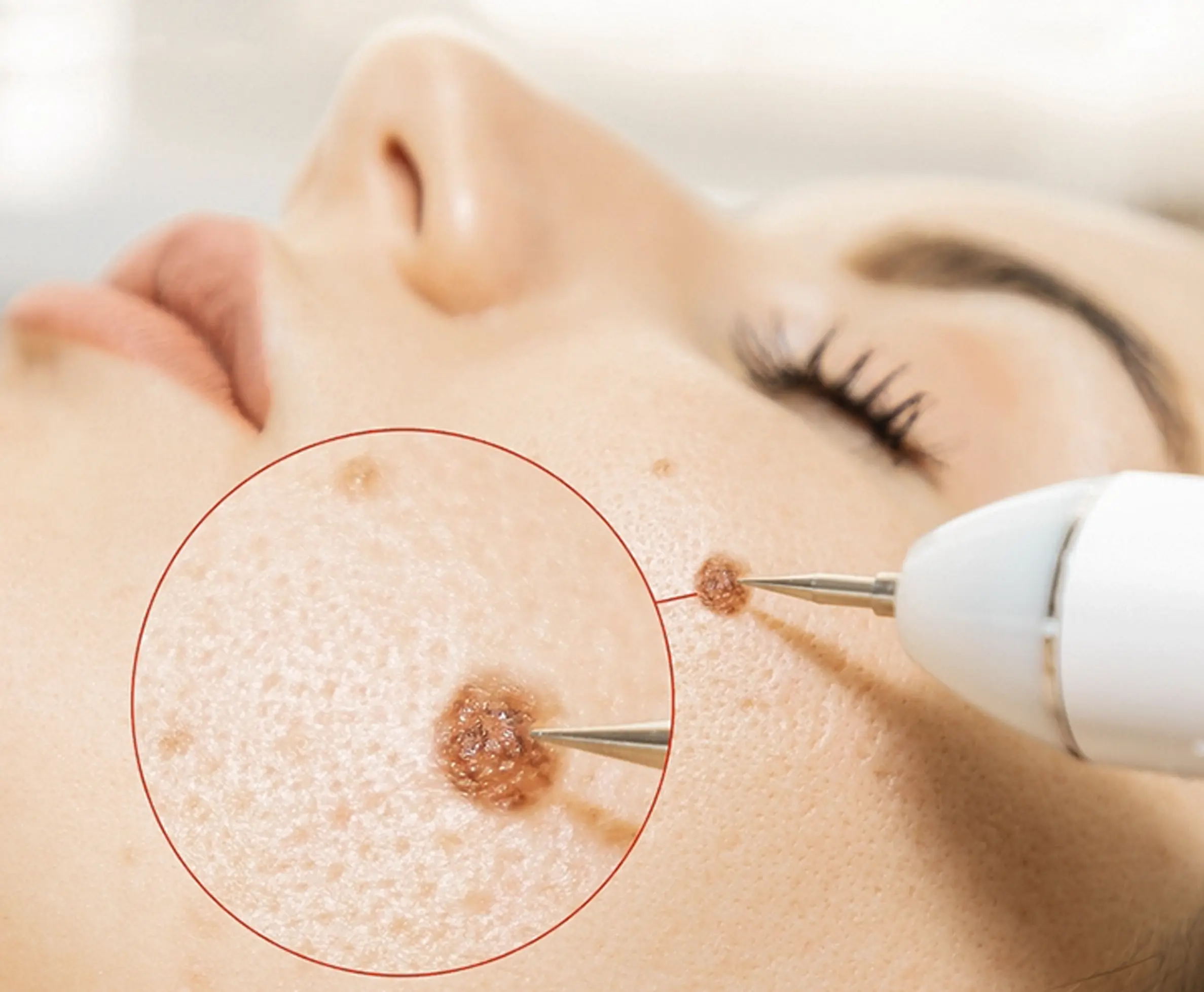 Treatment Duration and Results