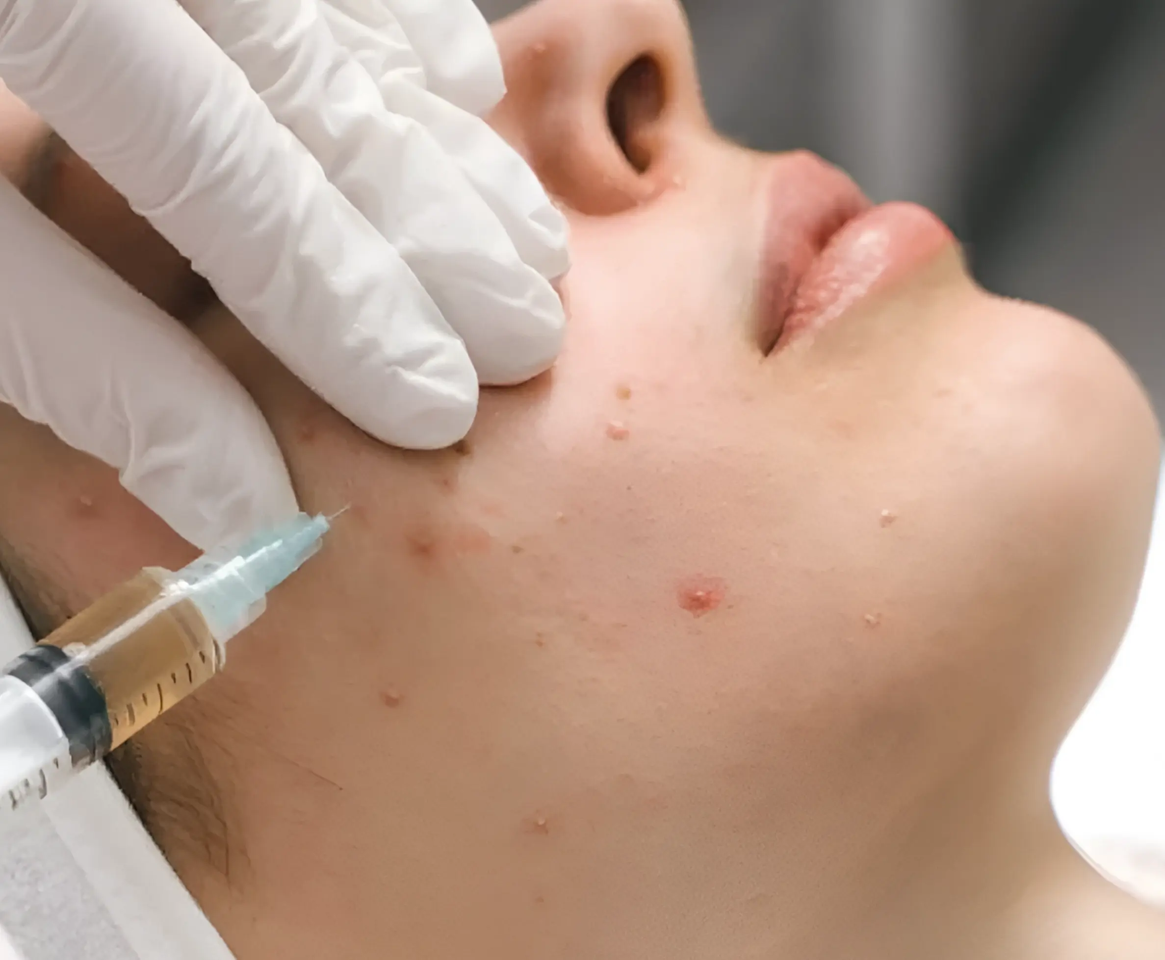 Treatment Duration and Results