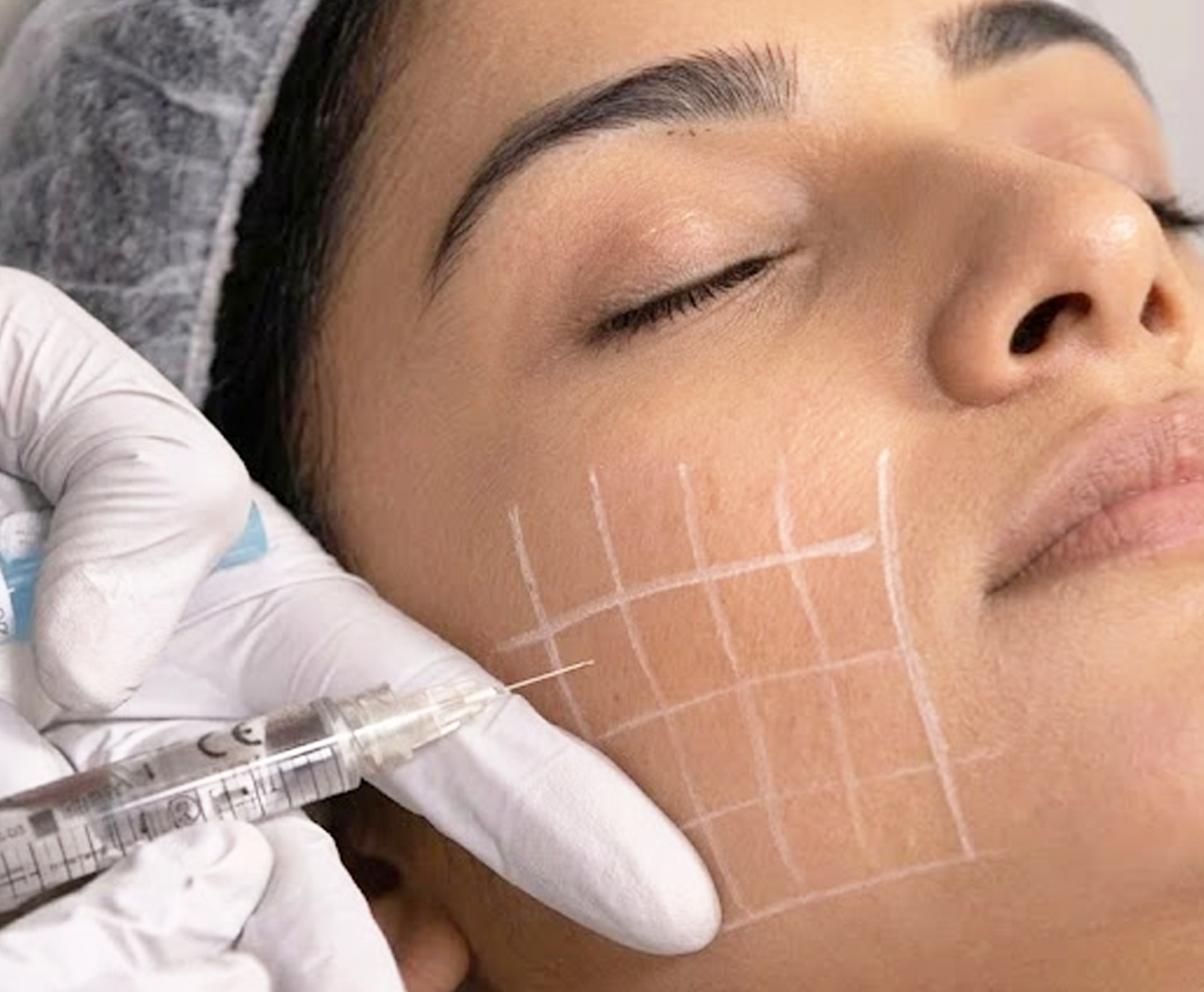 Why Choose Skin Booster Treatment?
