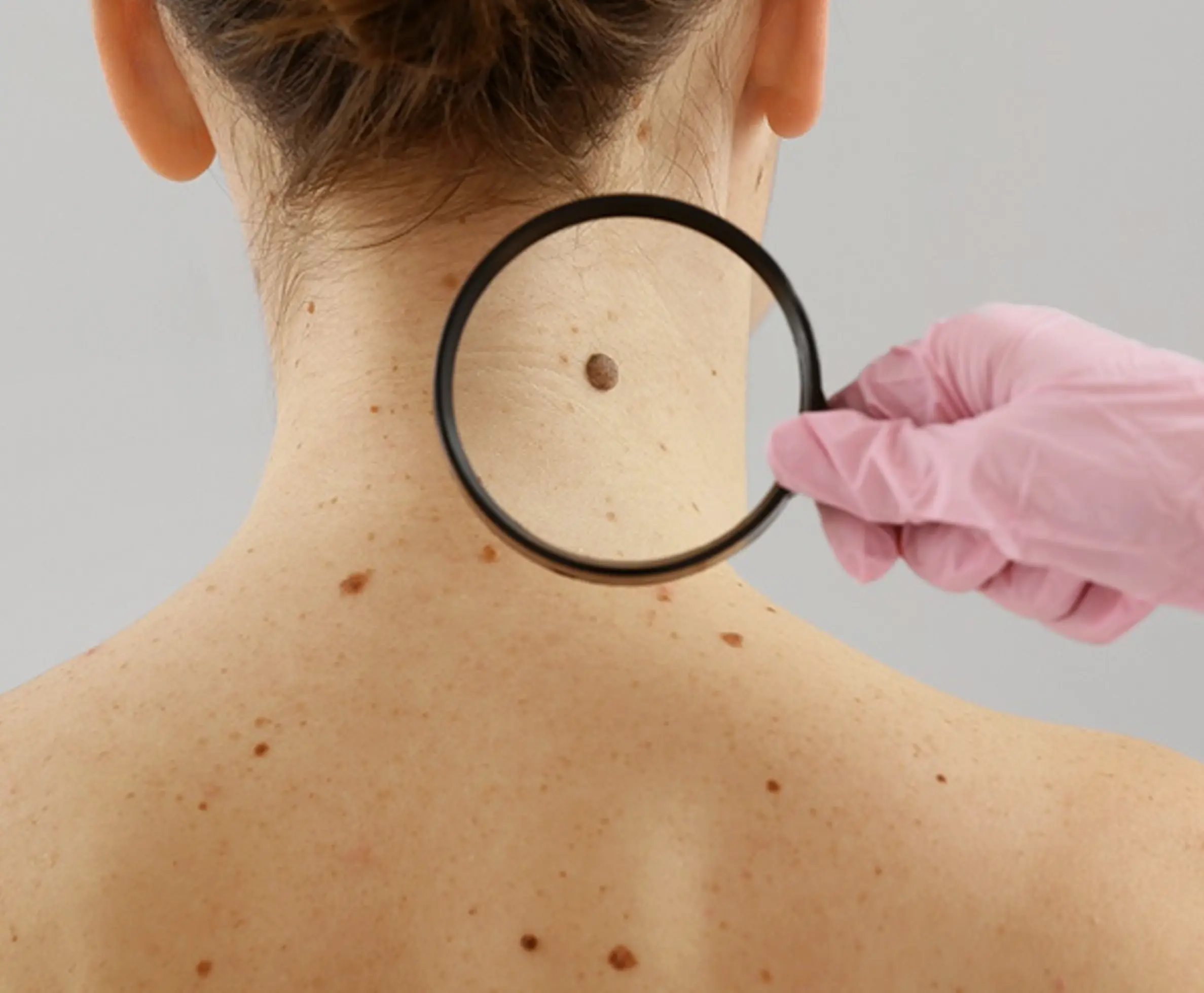 Treatment Duration and Results