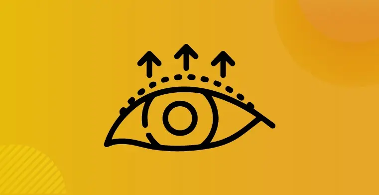 Blepharoplasty