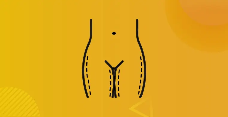 Thigh Lift